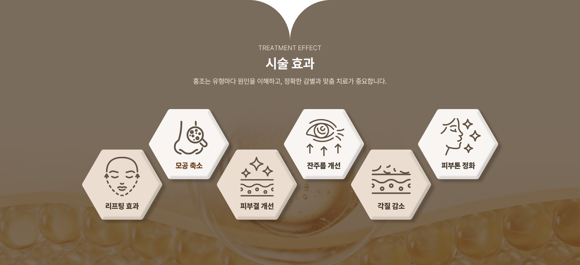 리쥬란 섹션 이미지