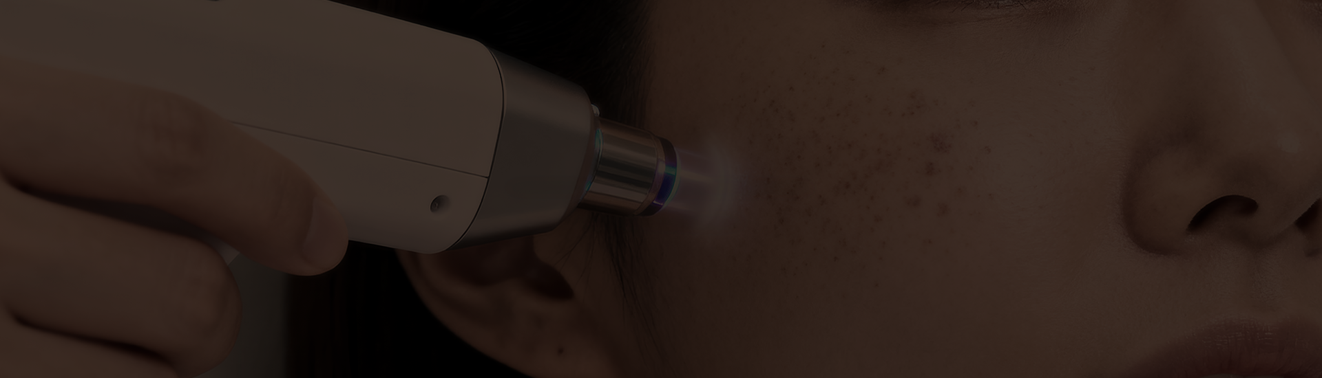 기미/잡티/주근깨